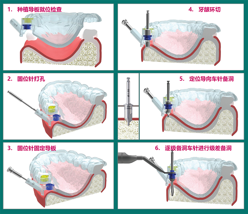 多級(jí)導(dǎo)板應(yīng)用流程圖-800.jpg